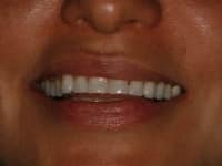 Konig Center for Cosmetic & Comprehensive Dentistry smile photos